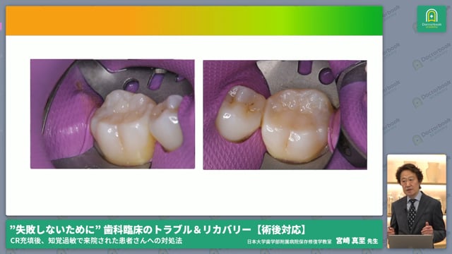 術後の知覚過敏を起こさないためにできる対処法