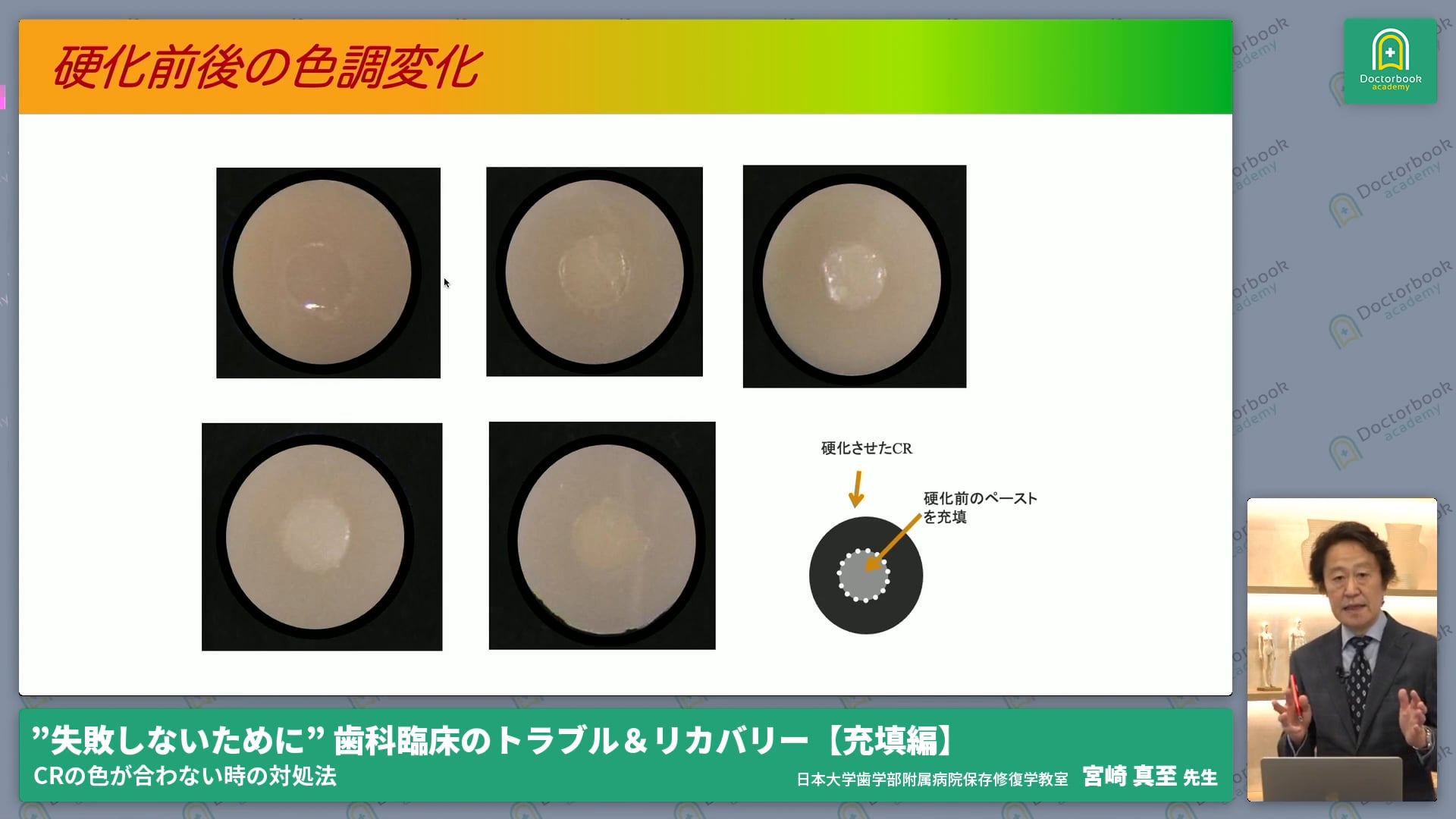 これで解決！！CR修復時、なかなか合わない色のトラブルへの対処法