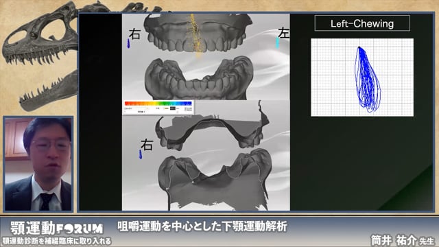下顎運動の解析～咀嚼運動からわかることとデジタル化の変遷～							