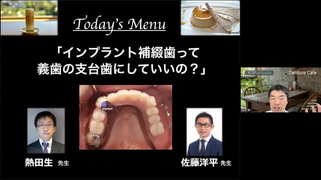 インプラント補綴歯って義歯の支台歯にしていいの？│Denture Cafe 第51回