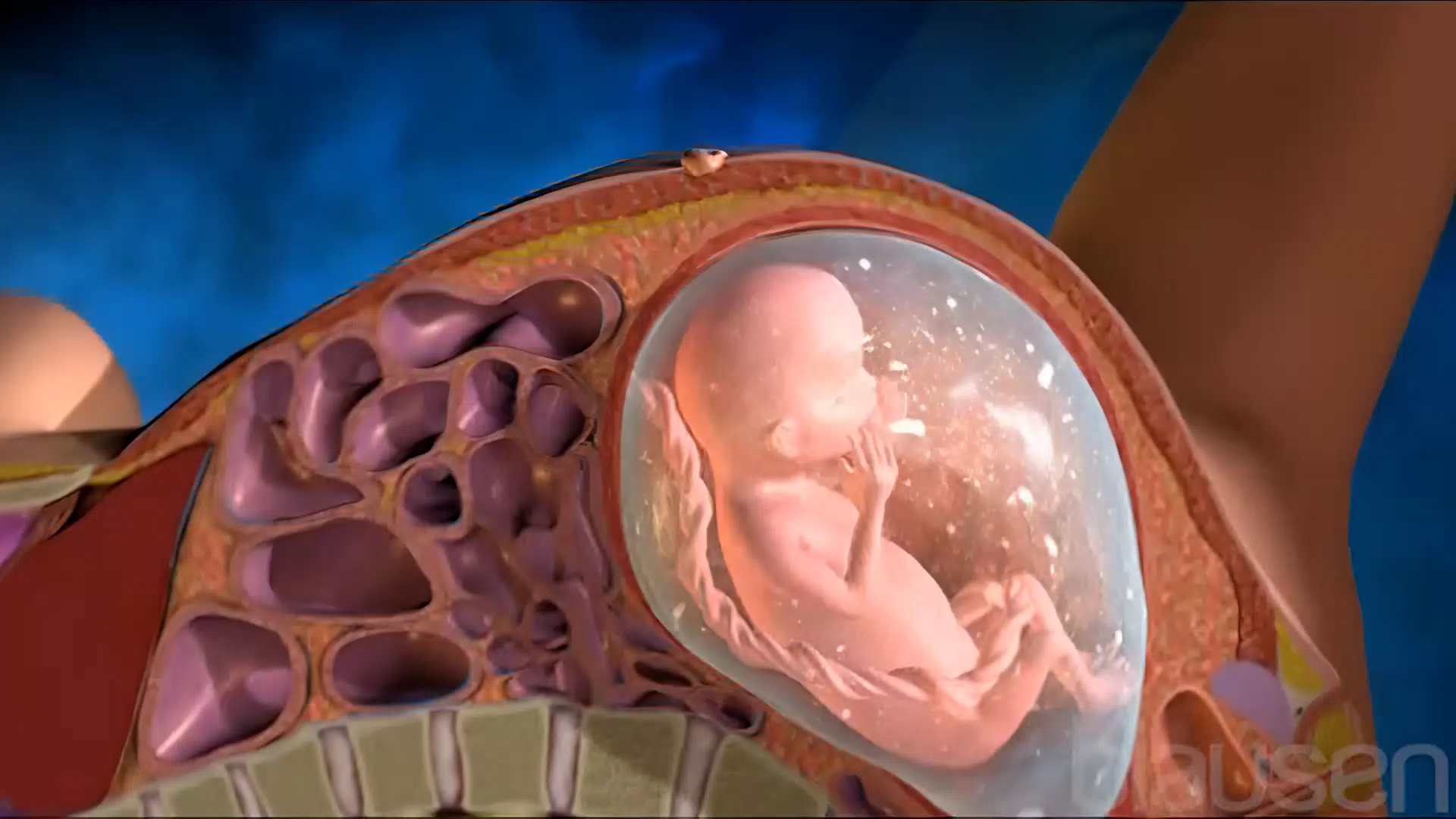 162_Amniocentesis_FRE_FR_HD_1920x1080