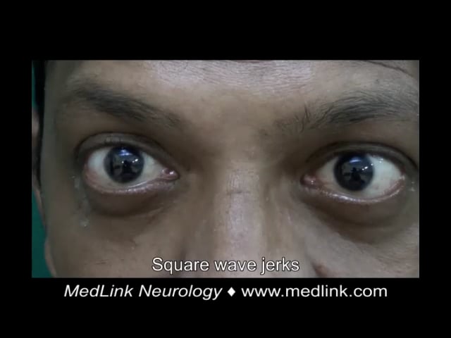 Cerebrotendinous xanthomatosis in a 44-year-old Indian man