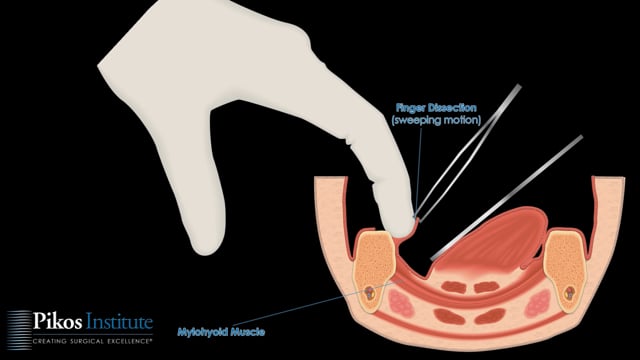 Surgery Animation