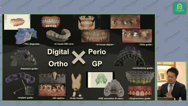 Digital × Ortho × Perio × GP ｜私のラーニングカーブと印象に残る症例を振り返る #2 月星陽介先生