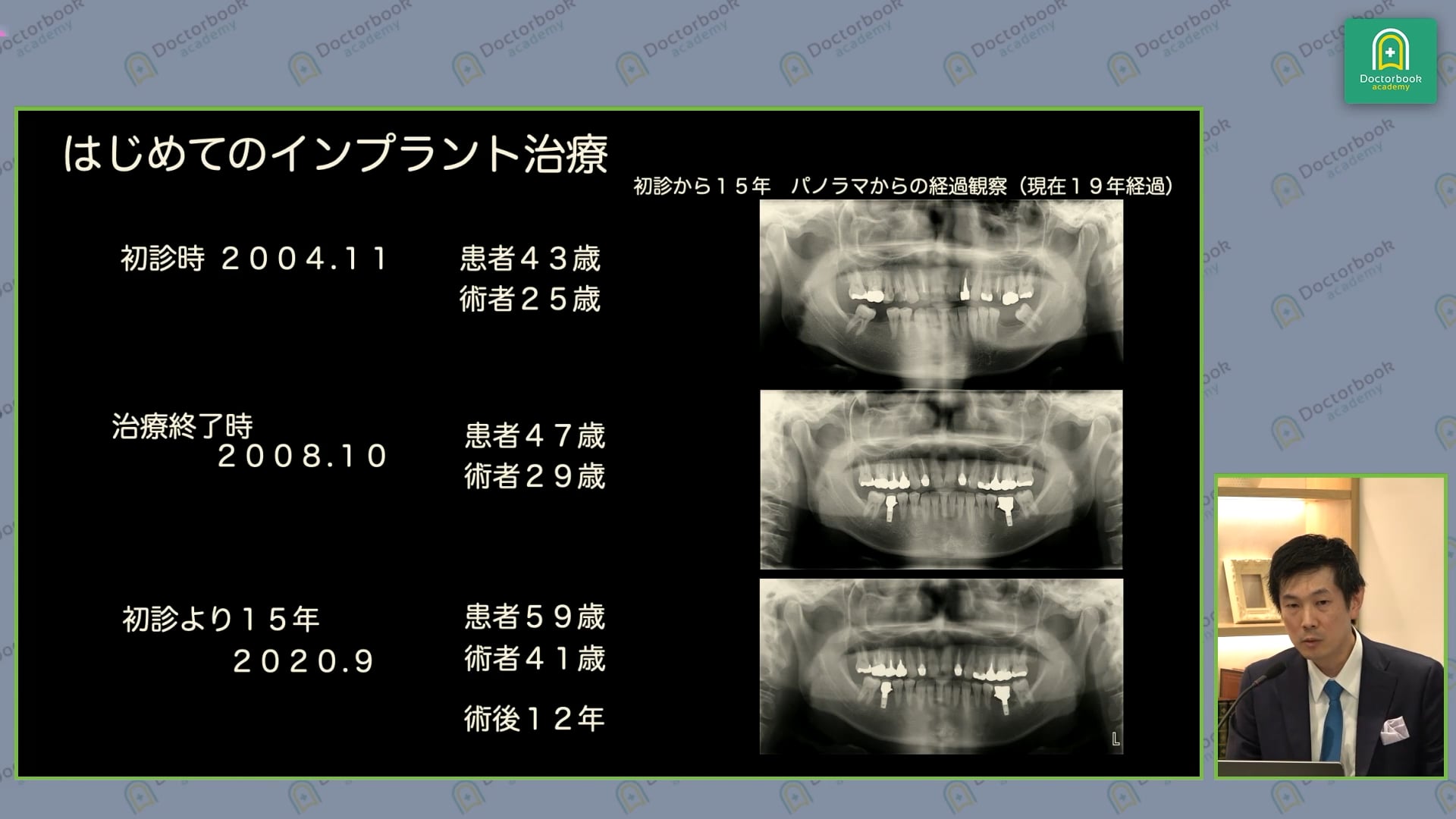 My Learning Stage｜私のラーニングカーブと印象に残る症例を振り返る #3 相宮秀俊先生