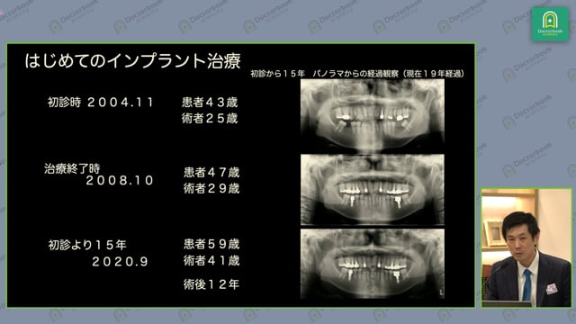 My Learning Stage｜私のラーニングカーブと印象に残る症例を振り返る #3 相宮秀俊先生