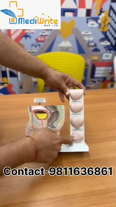 3D Prostate Model and its Different Stages
