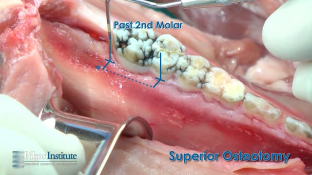 Surgical Instruction Video