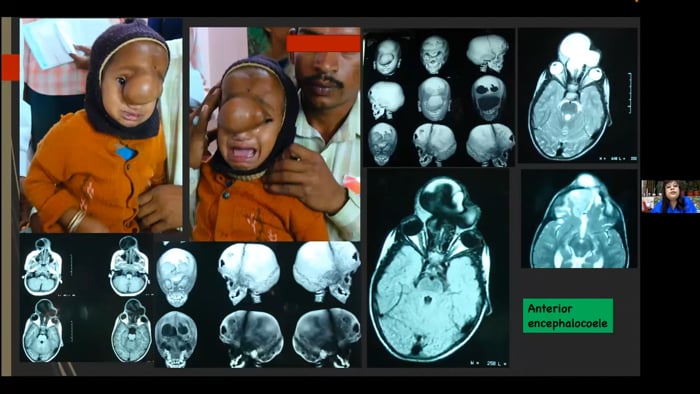 Differential diagnosis for skull congenital anomalies and physiological deformities