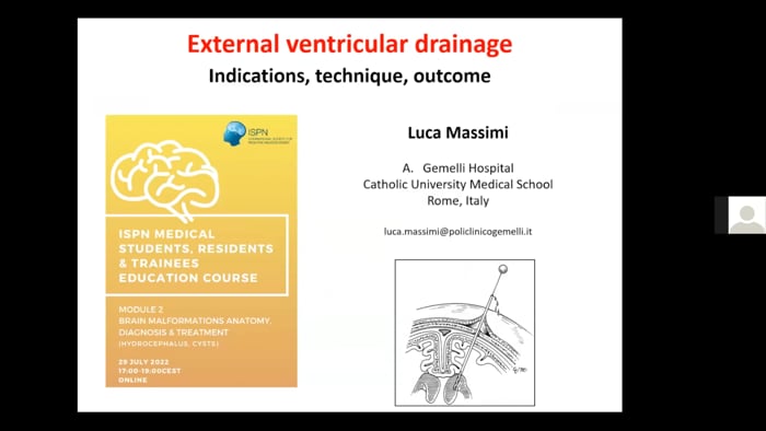 External Ventricular Drain EVD - Indications, Techniques, Outcomes