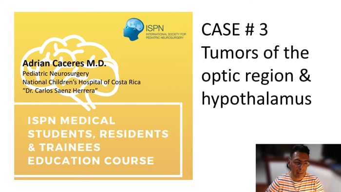 Tumors of the optic region/hypothalamus