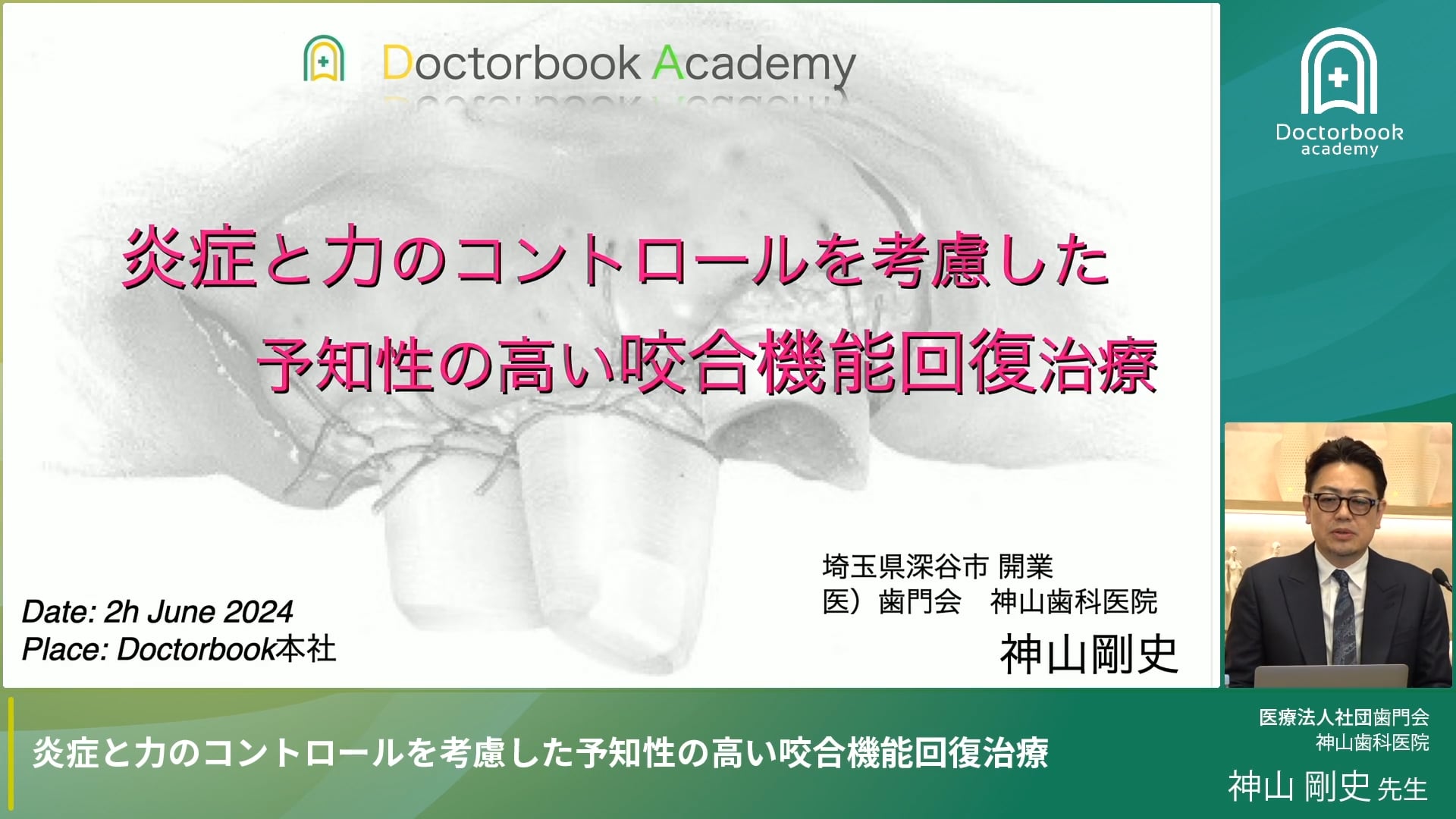 歯周病患者に対する補綴治療について｜炎症と力のコントロールを考慮した予知性の高い咬合機能回復治療 #1