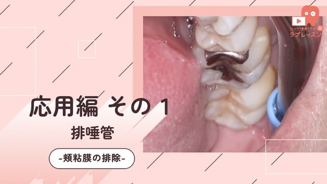 03.応用編 その１-頬粘膜の排除-