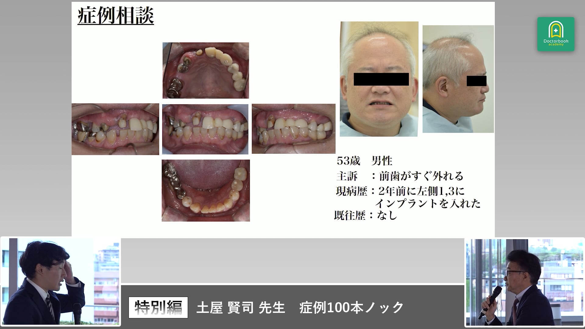 土屋賢司先生 症例100本ノック 特別編 PART1