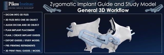 Zygomatic Implant Guide Workflow