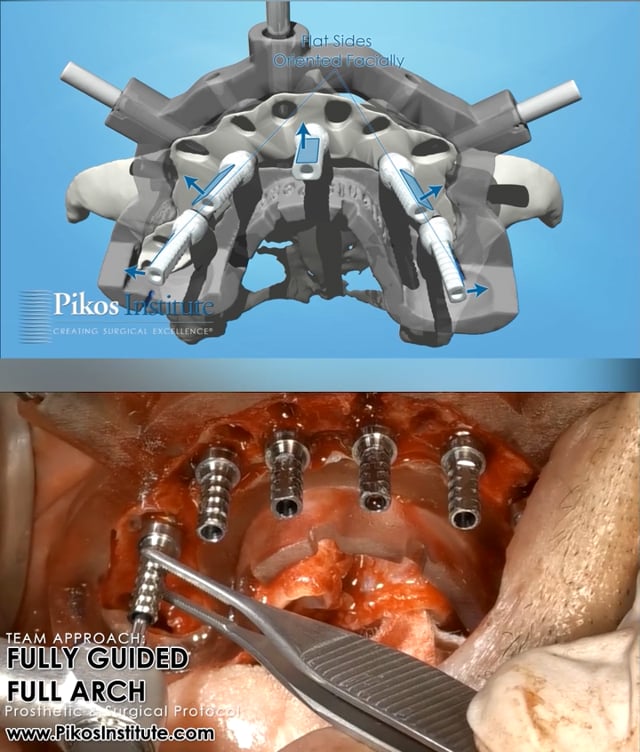 Oral Surgery with Animation