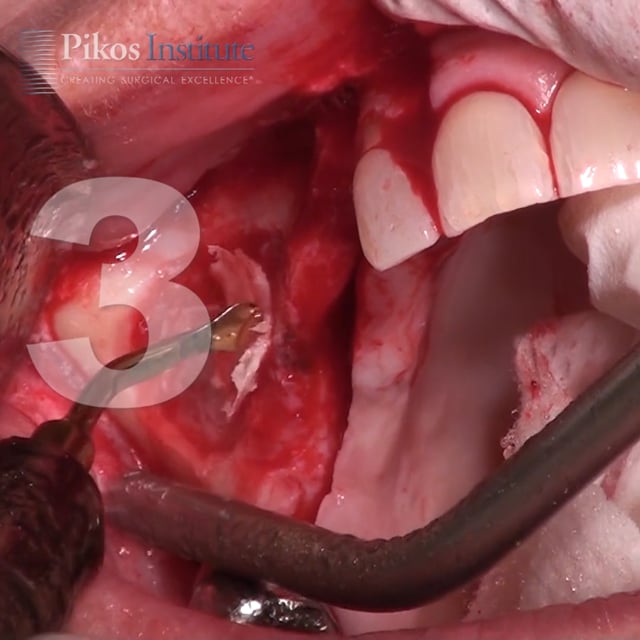 Surgery Social Media Video