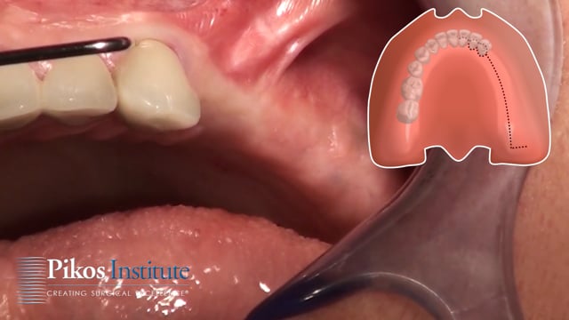 Surgical Videography