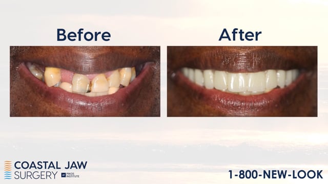 Dentistry Before and After