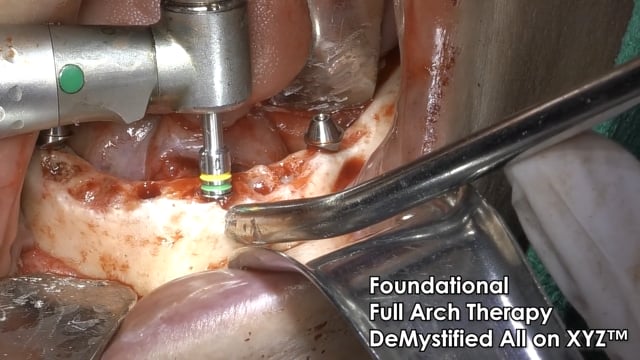 Surgery Videography