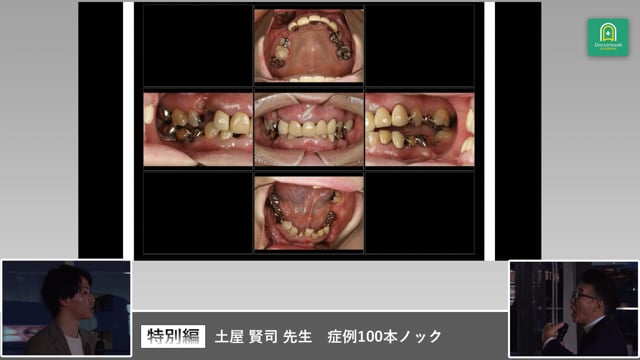 土屋賢司先生 症例100本ノック 特別編 PART2