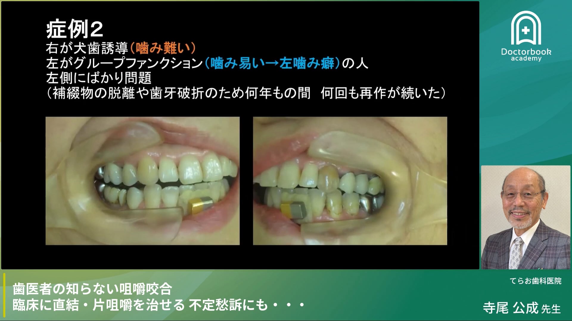 噛み難い原因と症例解説