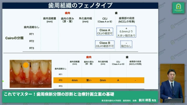 これでマスター！歯周病新分類の診断と治療計画立案の基礎
