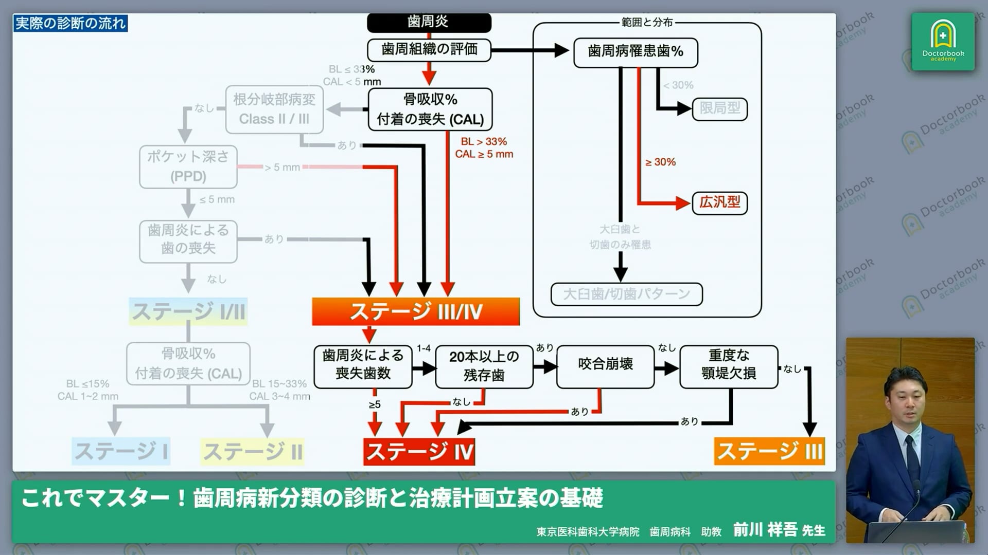 歯周炎の治療計画立案のコツ-基礎編-│Part7