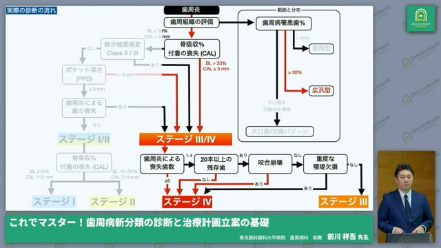 歯周炎の治療計画立案のコツ-基礎編-│Part7