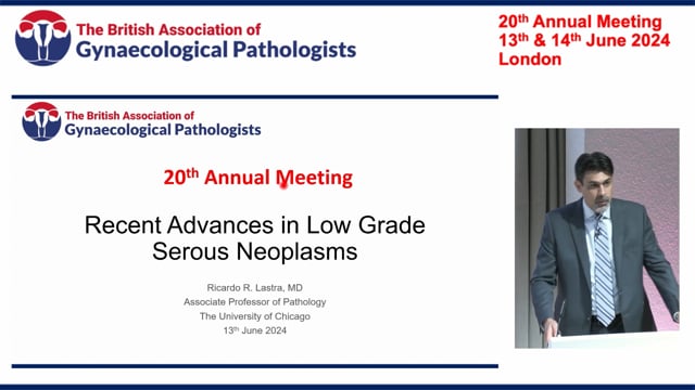 Recent advances in low grade serous neoplasms, Prof Ricardo Lastra