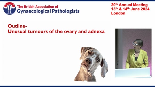 Unusual ovarian tumours, Dr Sabrina Croce