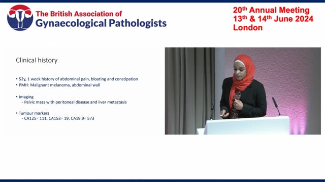 Case presentation – Ovarian tumour, Dr Razaan Yousif