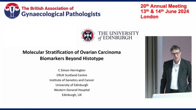 Biomarkers in ovarian cancers, Prof Simon Herrington