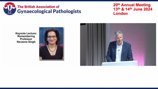 Keynote lecture in memory of Prof Singh – Updates in Low grade endometrial cancer, Prof Glenn McCluggage