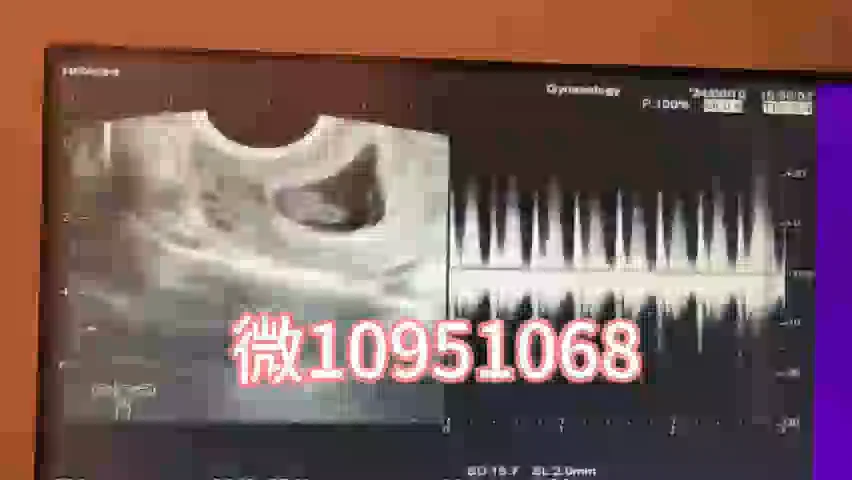 加州代孕费用（微信56109651）加州代孕联系方式 on Vimeo