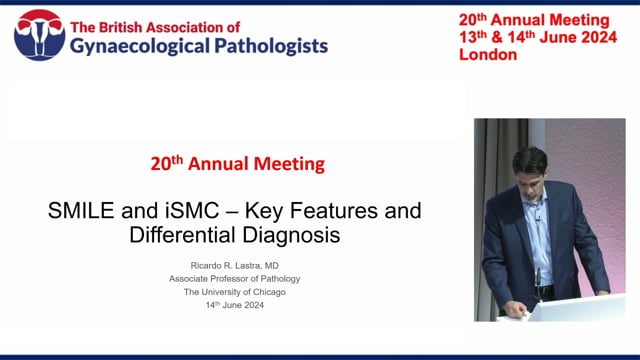 SMILE and iSMILE – key features and differential diagnosis, Prof Ricardo Lastra