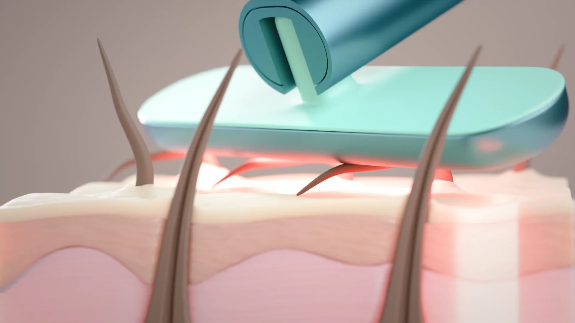 TRESSELIX - niccktownsend