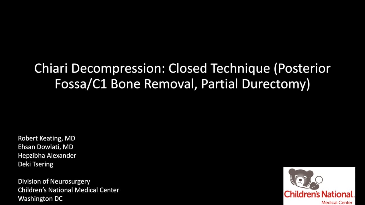Chiari Decompression: Closed Technique(Posterior Fossa Decomprssion, C1 laminectomy, partial durectomy)