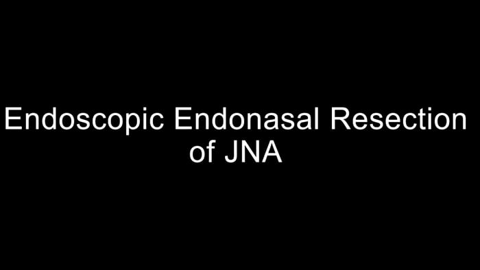 Endoscopic Endonasal approach for Juvenile Nasopharyngeal  Angiofibroma