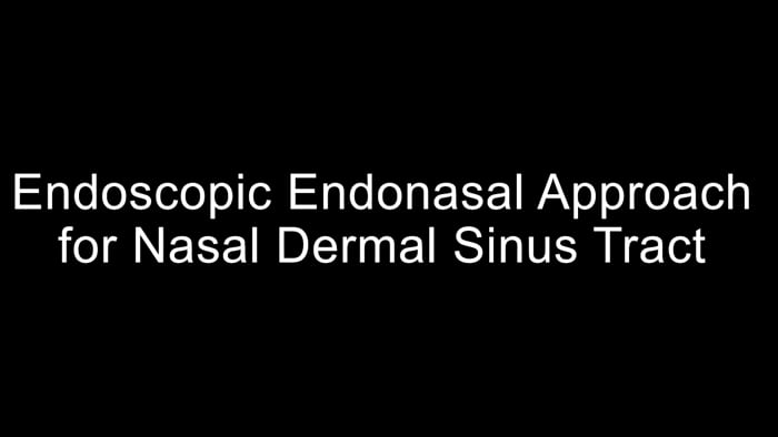 Endoscopic Endonasal Approach for Dermal Sinus Tract