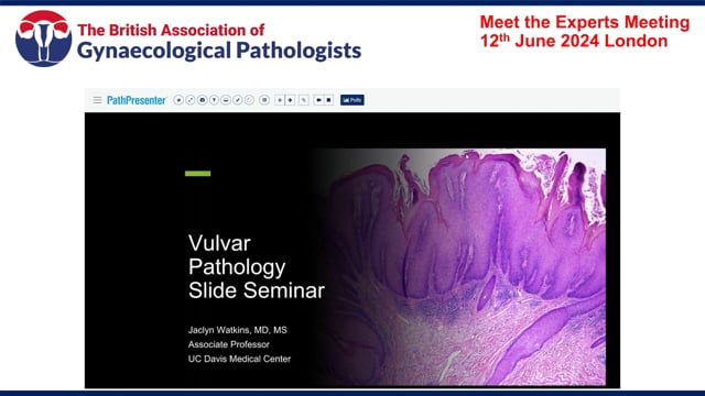 Slide Seminar: Vulval pathology, Prof Jaclyn Watkins