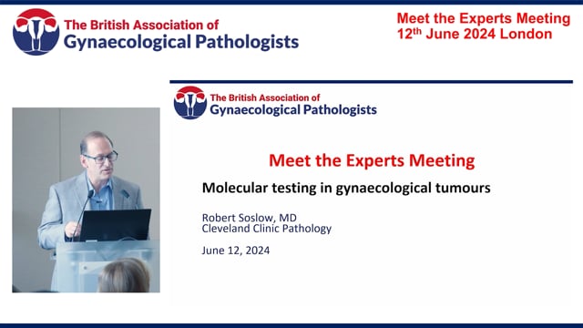 Slide Seminar: Molecular testing in gynae tumour, Prof Rob Soslow