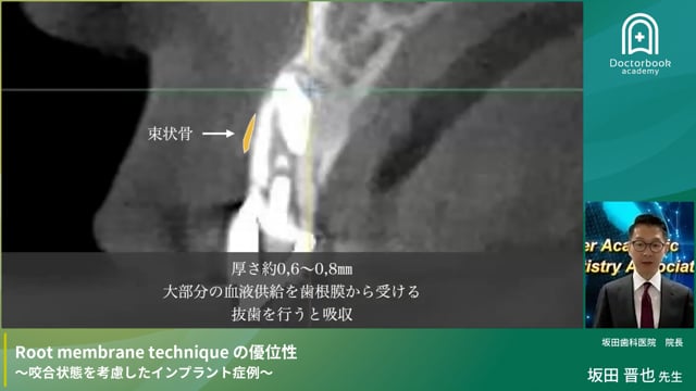 Root membrane techniqueの優位性 ~咬合状態を考慮したインプラント症例~