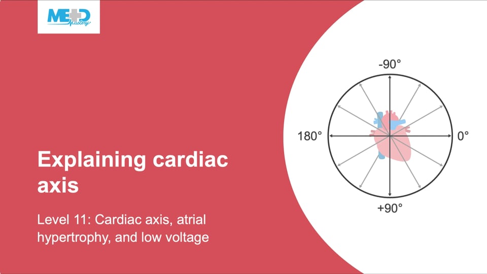 Cardiac Axis