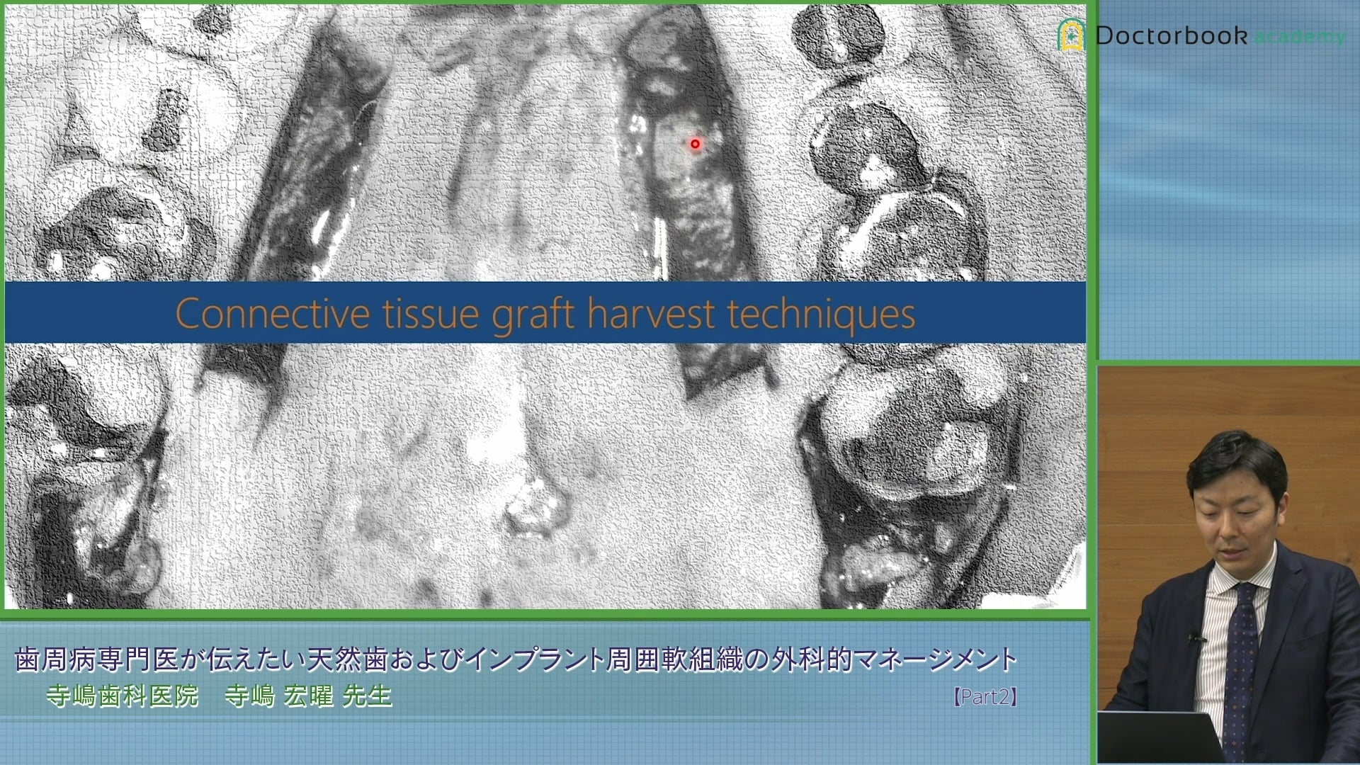 臨床知見録_結合組織移植術_解剖の生理像