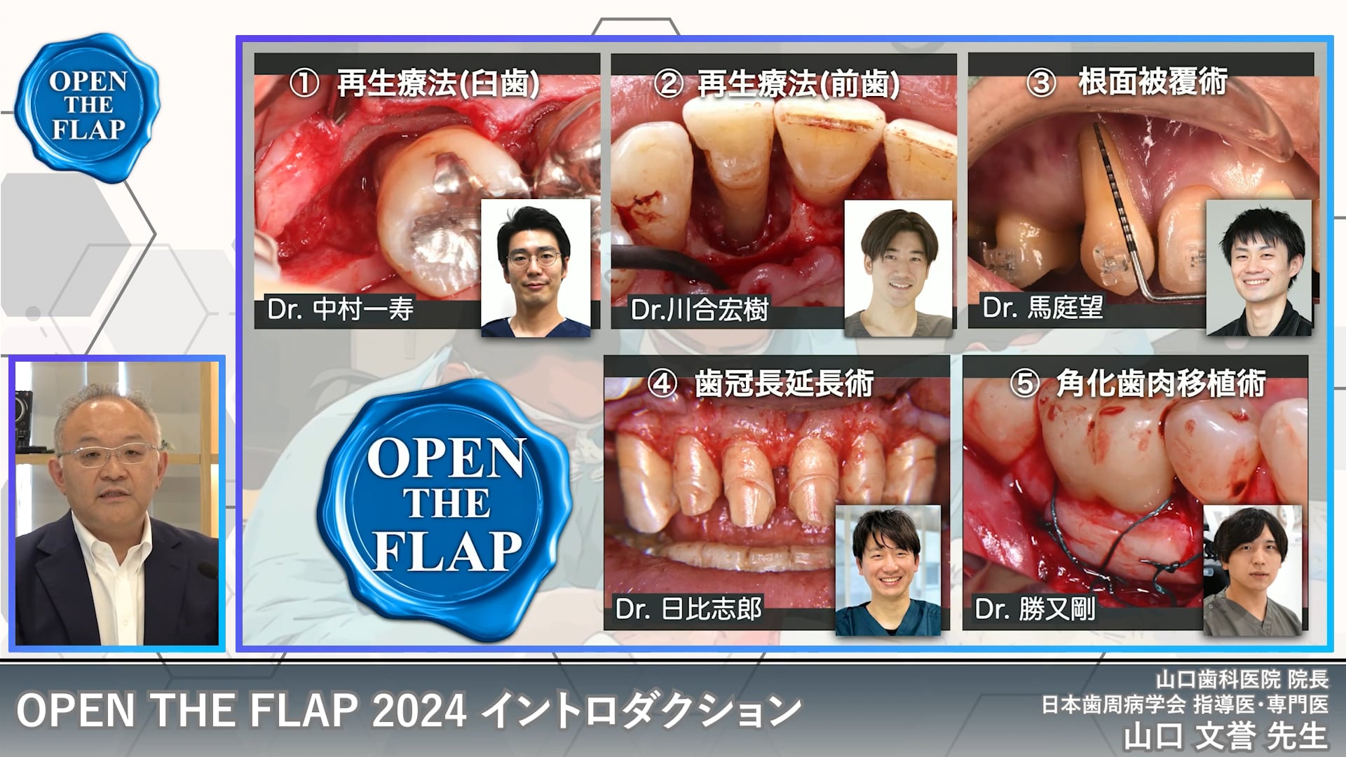 #0 OPEN THE FLAP2024 概要