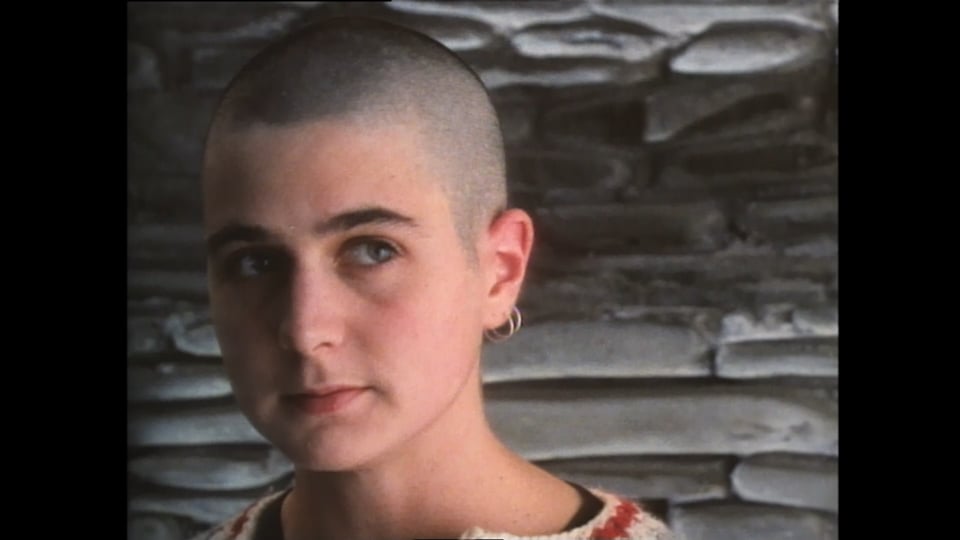On Her Baldness