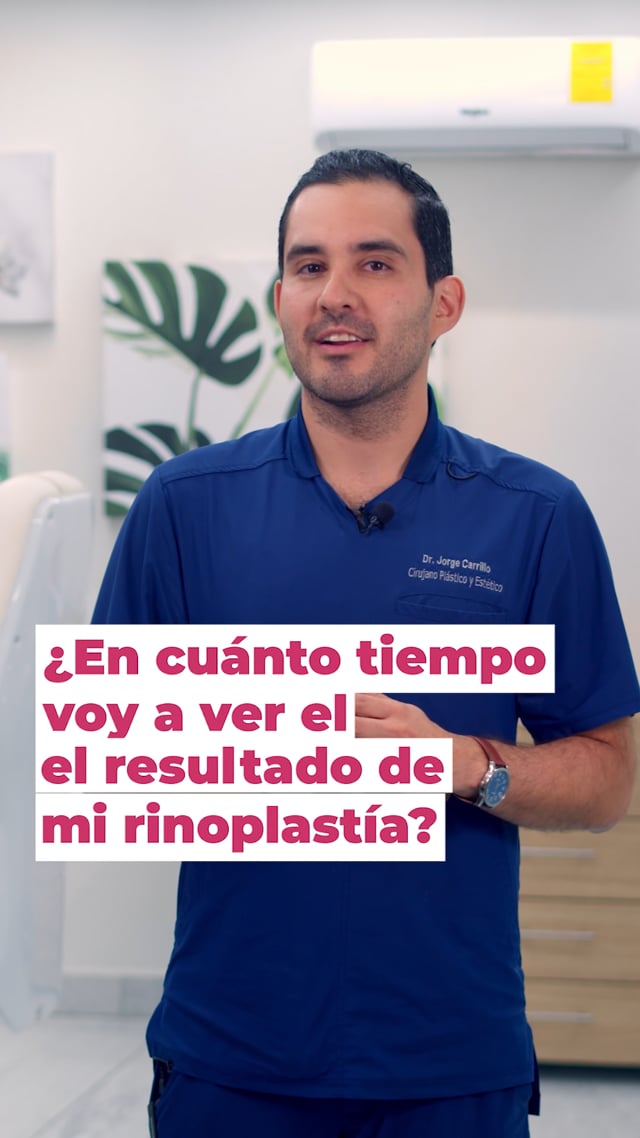 ¿En cuanto tiempo voy a ver el resultado de mi rinoplastía?