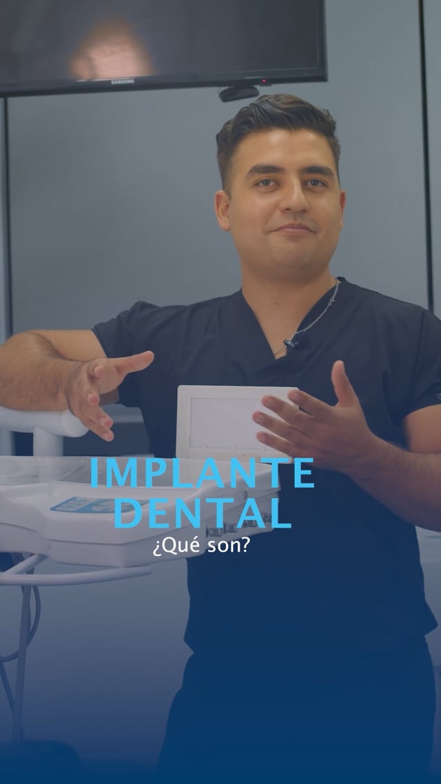 Implante dental ¿qué son?