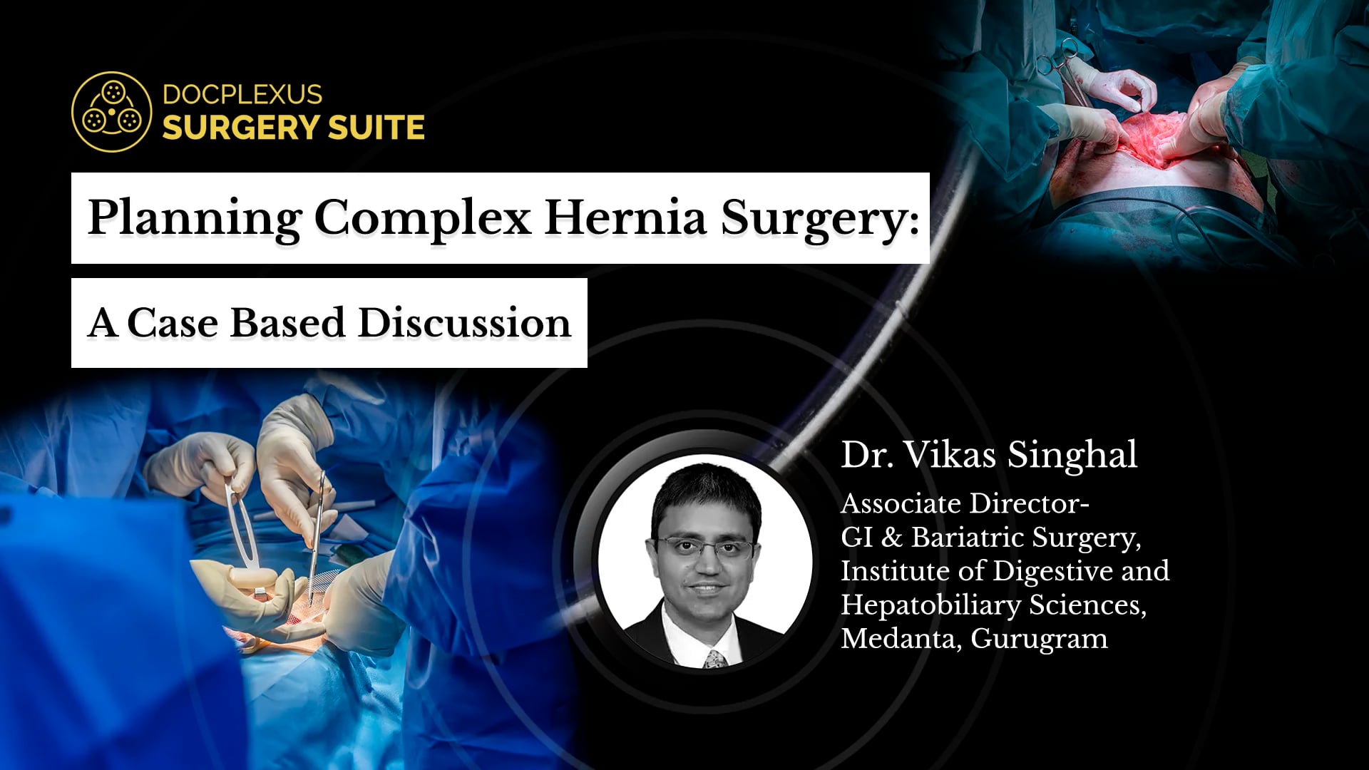 Planning Complex Hernia Surgery: A Case-based Discussion